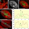 eick_berchtold__chromosome_res_2011_500.100x0.jpg